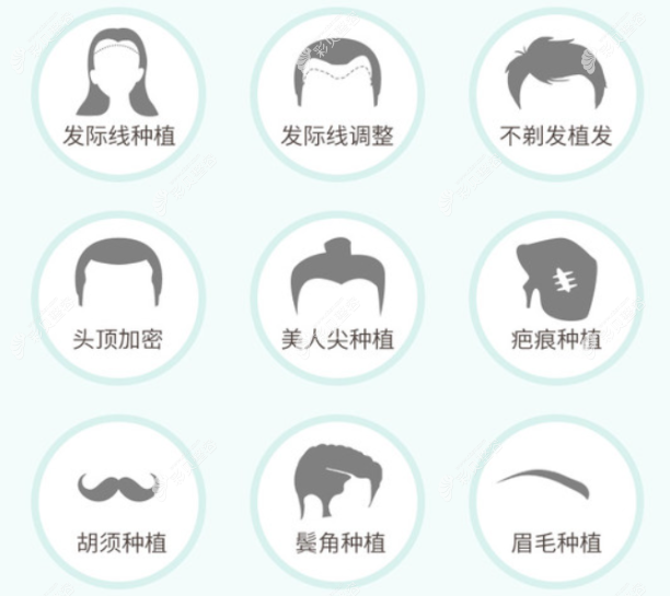 南京天際植發(fā)醫(yī)院做發(fā)際線植發(fā)怎么樣