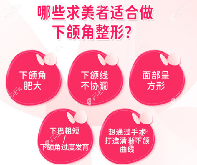 柳超醫(yī)生做下頜角截骨手術(shù)多少錢