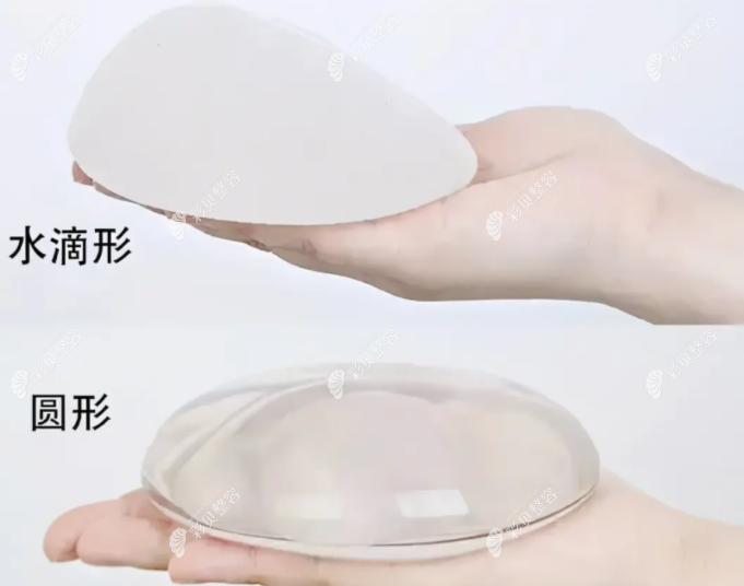 莆田女人花整形吳建超醫(yī)生做假體隆胸手術(shù)怎么樣 莆田女人花整形吳建超醫(yī)生做假體隆胸手術(shù)怎么樣